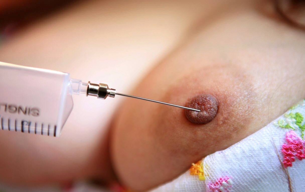 Needles nipple